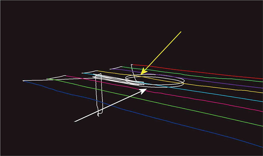 SKY-Mapper MarkⅡ